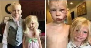 He saved his sister from a ferocious Dog, don’t skip without giving him some love..watch full story👇👇 