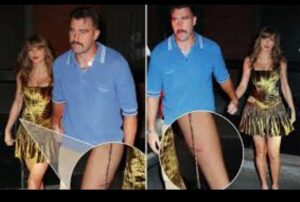 Earlier today, fans noticed what appeared to be burn marks on Taylor Swift's arm in a recently surfaced photo.