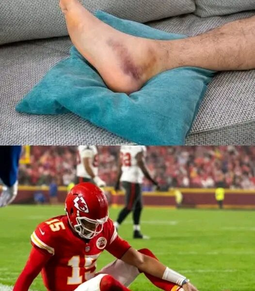 BREAKING: “5 minutes ago, Chiefs’ QB Patrick Mahomes officially announced his retirement due to a severe injury