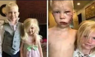 He saved his sister from a ferocious Dog, don’t skip without giving him some love..watch full story👇👇