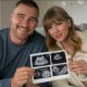 Just in: Congratulations Baby on the Way! Taylor Swift & Travis Kelce Share Sweet Pregnancy Announcement with Heartwarming Ultrasound…See more⤵️⤵️